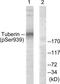 TSC Complex Subunit 2 antibody, LS-C199699, Lifespan Biosciences, Western Blot image 