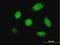 Dual Specificity Phosphatase 5 antibody, H00001847-M04, Novus Biologicals, Immunofluorescence image 