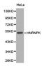 Heterogeneous Nuclear Ribonucleoprotein K antibody, LS-C192796, Lifespan Biosciences, Western Blot image 