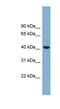 Beta-1,4-Galactosyltransferase 2 antibody, NBP1-59863, Novus Biologicals, Western Blot image 