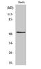Death Associated Protein Kinase 3 antibody, STJ92654, St John