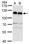 SRBP1 antibody, GTX101574, GeneTex, Western Blot image 