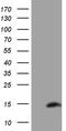 SH3 Domain Binding Glutamate Rich Protein Like antibody, M13363, Boster Biological Technology, Western Blot image 