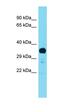 Pancreas Associated Transcription Factor 1a antibody, orb329915, Biorbyt, Western Blot image 