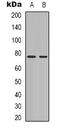 Bruton Tyrosine Kinase antibody, orb338876, Biorbyt, Western Blot image 