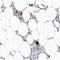 Integrin Subunit Alpha 2b antibody, NBP1-84581, Novus Biologicals, Immunohistochemistry frozen image 