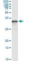 NAD(P)H Quinone Dehydrogenase 1 antibody, H00001728-M01, Novus Biologicals, Immunoprecipitation image 