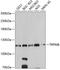 Transient Receptor Potential Cation Channel Subfamily M Member 8 antibody, 19-595, ProSci, Western Blot image 