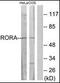 RAR Related Orphan Receptor A antibody, orb95615, Biorbyt, Western Blot image 
