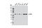 Beta-Transducin Repeat Containing E3 Ubiquitin Protein Ligase antibody, 11984S, Cell Signaling Technology, Western Blot image 