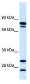 Zinc Finger Protein 606 antibody, TA333658, Origene, Western Blot image 