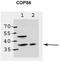 COP9 Signalosome Subunit 6 antibody, TA342587, Origene, Western Blot image 