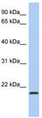 RWD Domain Containing 4 antibody, TA337876, Origene, Western Blot image 