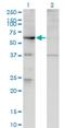 Rho Guanine Nucleotide Exchange Factor 5 antibody, H00007984-M02, Novus Biologicals, Western Blot image 