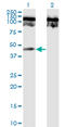 TNF Receptor Superfamily Member 19 antibody, LS-C139118, Lifespan Biosciences, Western Blot image 