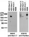 Sodium channel protein type 9 subunit alpha antibody, 73-103, Antibodies Incorporated, Western Blot image 