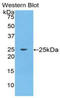 Fibroblast Growth Factor 9 antibody, LS-C372406, Lifespan Biosciences, Western Blot image 