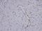 Coronin 1C antibody, GTX106469, GeneTex, Immunohistochemistry paraffin image 