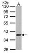 Exostosin Like Glycosyltransferase 2 antibody, GTX114395, GeneTex, Western Blot image 