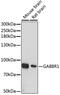 Gamma-Aminobutyric Acid Type B Receptor Subunit 1 antibody, 13-694, ProSci, Western Blot image 