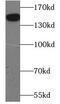 Thrombospondin 2 antibody, FNab09828, FineTest, Western Blot image 