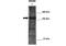 Arginine-Glutamic Acid Dipeptide Repeats antibody, 25-464, ProSci, Western Blot image 