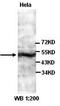 Carbonic Anhydrase 9 antibody, orb77179, Biorbyt, Western Blot image 