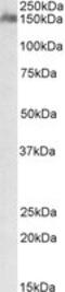 CUB And Sushi Multiple Domains 1 antibody, MBS422027, MyBioSource, Western Blot image 