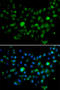 Minichromosome Maintenance 10 Replication Initiation Factor antibody, STJ29279, St John