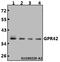 G Protein-Coupled Receptor 42 (Gene/Pseudogene) antibody, A13013-1, Boster Biological Technology, Western Blot image 