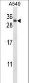 RAB11A, Member RAS Oncogene Family antibody, LS-C162355, Lifespan Biosciences, Western Blot image 