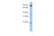 RING finger protein 219 antibody, 25-849, ProSci, Enzyme Linked Immunosorbent Assay image 
