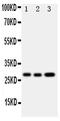 Oncostatin M antibody, PA5-79773, Invitrogen Antibodies, Western Blot image 