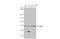 Checkpoint Kinase 2 antibody, GTX70295, GeneTex, Western Blot image 