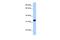 Acrosomal Vesicle Protein 1 antibody, PA5-44074, Invitrogen Antibodies, Western Blot image 