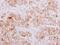 MADH9 antibody, GTX114540, GeneTex, Immunohistochemistry paraffin image 