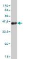 Tweety Family Member 1 antibody, H00057348-M04, Novus Biologicals, Western Blot image 