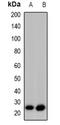 Growth Associated Protein 43 antibody, orb382520, Biorbyt, Western Blot image 