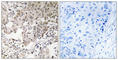 Non-SMC Condensin II Complex Subunit G2 antibody, abx014392, Abbexa, Western Blot image 