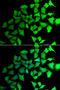 Transaldolase 1 antibody, STJ28845, St John