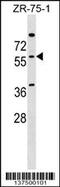 NOVA Alternative Splicing Regulator 2 antibody, 59-619, ProSci, Western Blot image 