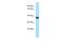 Transmembrane Protein 165 antibody, A08115, Boster Biological Technology, Western Blot image 