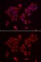 Retinoic Acid Receptor Responder 2 antibody, GTX32518, GeneTex, Immunocytochemistry image 