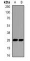 Polycomb Group Ring Finger 3 antibody, abx141985, Abbexa, Western Blot image 