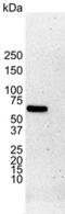 Estrogen Receptor 1 antibody, MCA1799T, Bio-Rad (formerly AbD Serotec) , Immunohistochemistry paraffin image 