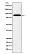 T-Box 3 antibody, M01107-1, Boster Biological Technology, Western Blot image 