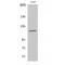 Protein Tyrosine Kinase 2 Beta antibody, LS-C385687, Lifespan Biosciences, Western Blot image 