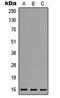 Mediator Complex Subunit 31 antibody, LS-C354420, Lifespan Biosciences, Western Blot image 