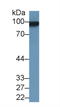 Melanoma Cell Adhesion Molecule antibody, LS-C374207, Lifespan Biosciences, Western Blot image 