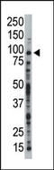 Tousled Like Kinase 1 antibody, AP15060PU-N, Origene, Western Blot image 